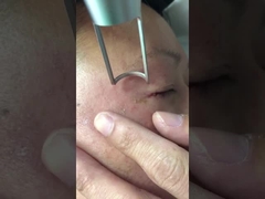 เครื่องเลเซอร์ Picosecond 450ps 1064nm 532nm Q สลับ Nd Yag