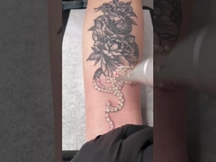 เครื่องเลเซอร์ Picosecond 450ps 1064nm 532nm Q สลับ Nd Yag